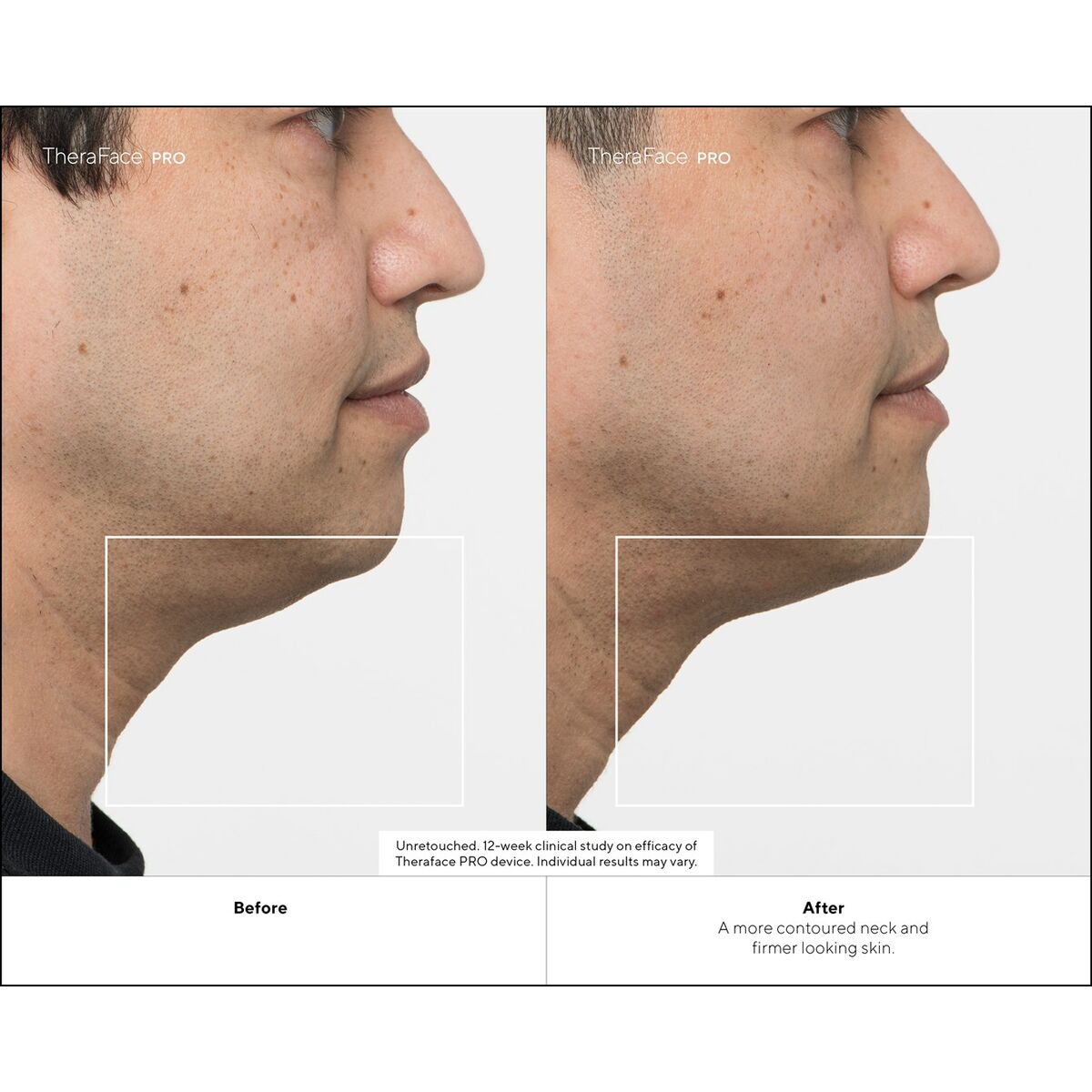 V4H291F3FAB679EF6B613818051630FEC45R4939055P8