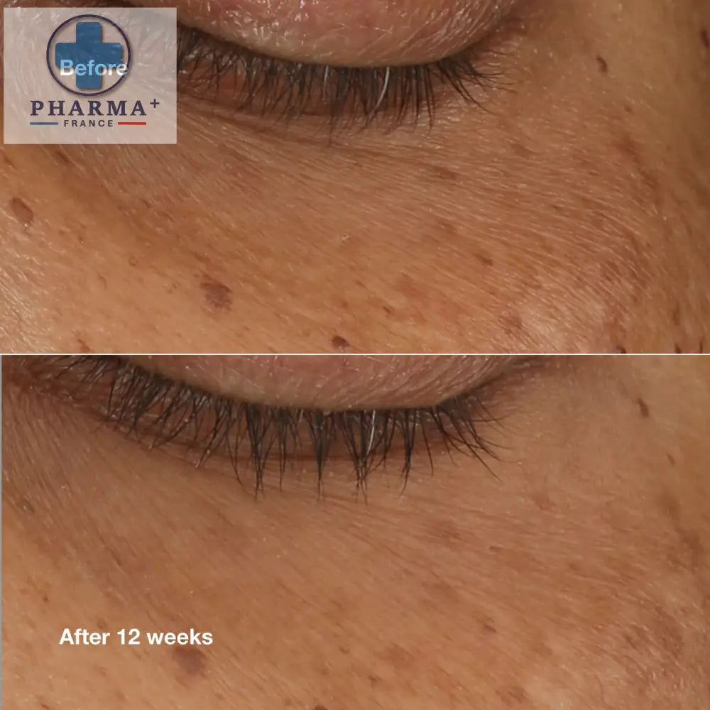 V5H8C7C1054D2ADF0B16E5C343758BDC6B4R6436466P2